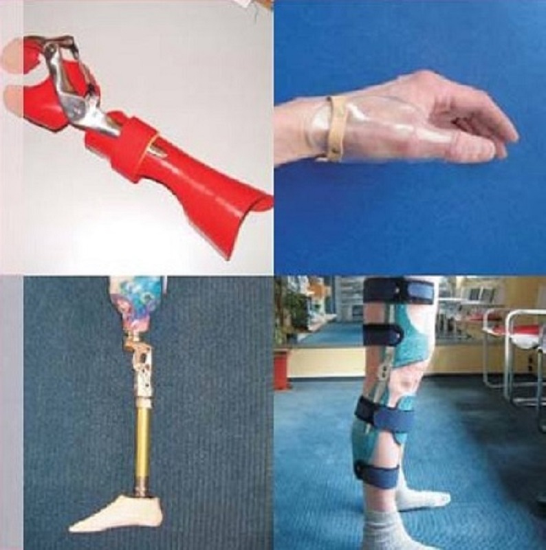 Beispielarbeit von D' Orthopädisten - Orthopädietechnik Sanitätshaus Barth GbR - veröffentlicht auf Sanimio.de