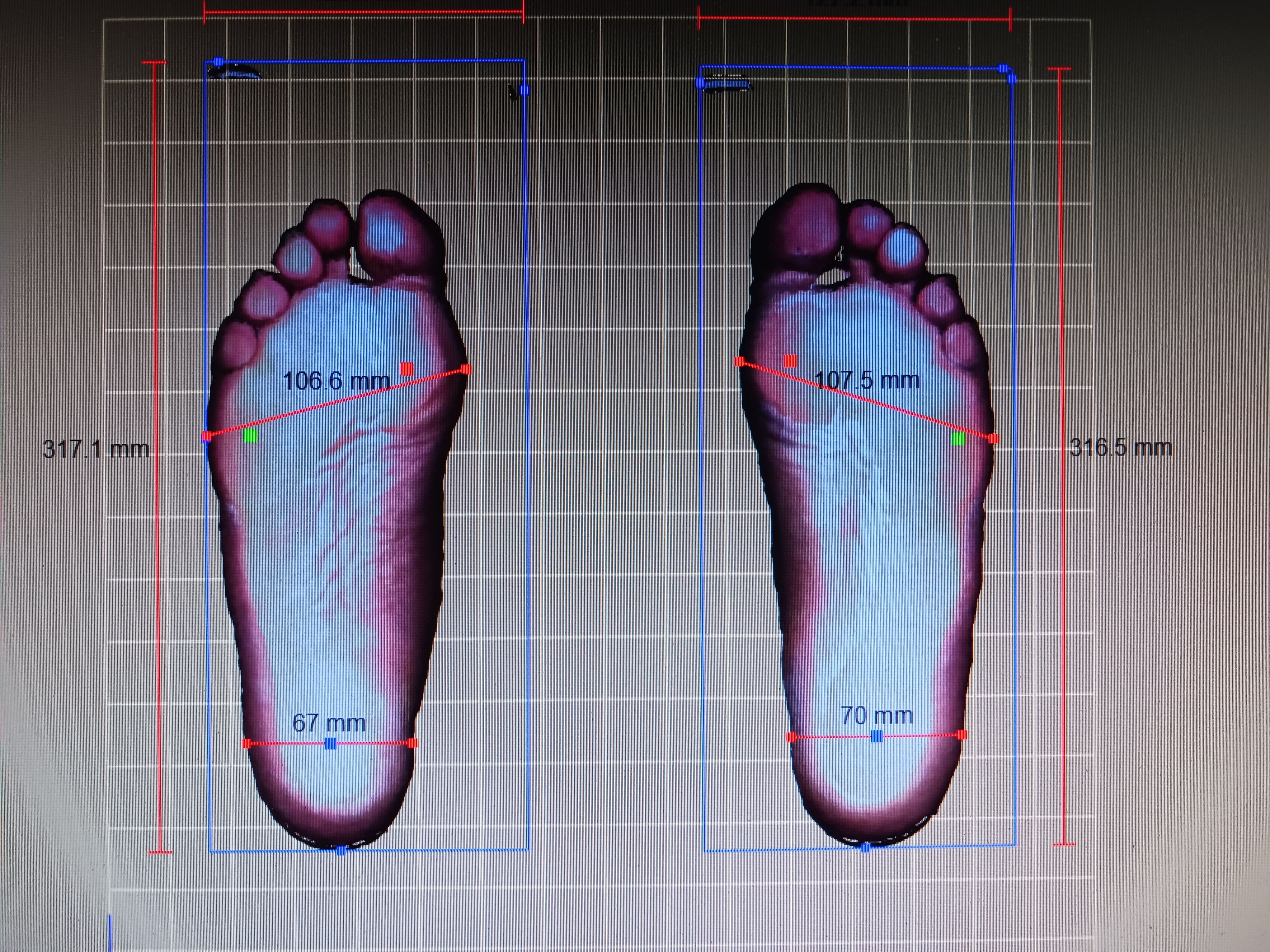 Beispielarbeit von Tim Mende Orthopädie-Schuhtechnik - veröffentlicht auf Sanimio.de