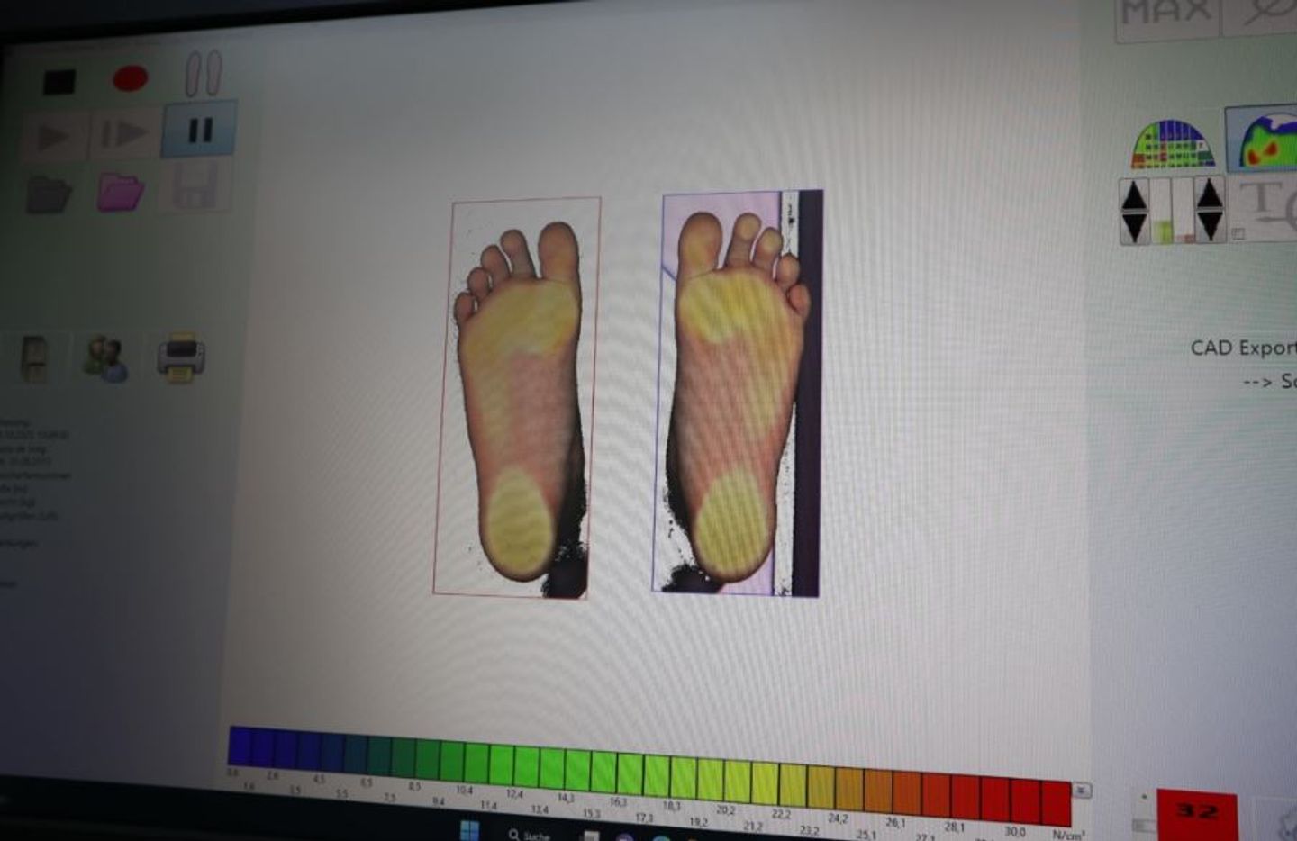 Beispielarbeit von DE JONG Sanitätshaus, Orthopädie-Technik - veröffentlicht auf Sanimio.de